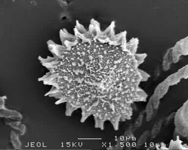 APII jpeg image of Fossombronia spiny 1'  © contact APII